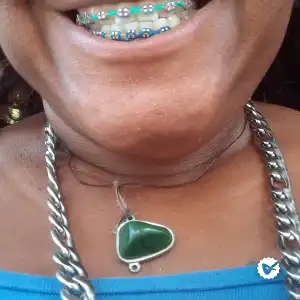 Carlapimemtilhar