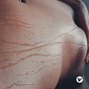 Melissa